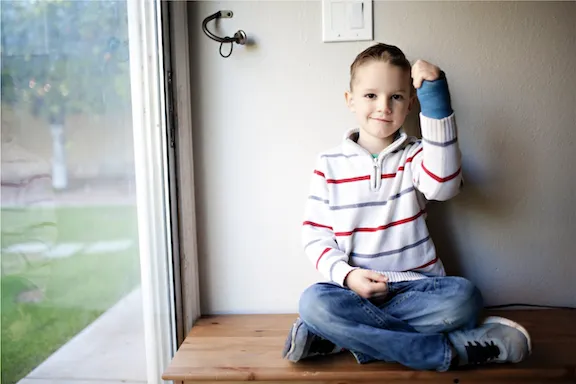 Photo: Kid with an arm cast