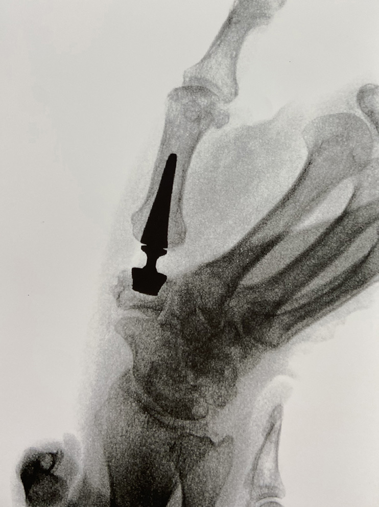 TOUCH x-ray